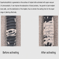 Activateur UV pour implants dentaires Ti-100, machine hydrophile pour surface d'implant dentaire à écran tactile en 15 secondes