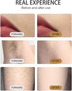 Appareil d'épilation au laser à diode à 4 longueurs d'onde portable avec grand écran pour le rajeunissement de la peau - Product Image 6