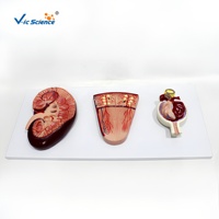 Modelo Anatómico de Glómerulo Renal con Ampliación, PVC, Ciencia Médica