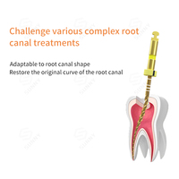 Pro Taper Super Flexible Rotary Endo Files Niti Dental Rotary Files para terapia oral Dental File Equipment Accesorio