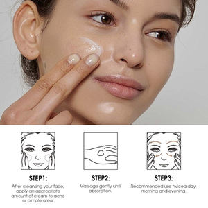 Crema para el acné más vendida, ingrediente de hierbas orgánicas, crema para espinillas de <span class=keywords><strong>piel</strong></span> suave e iluminadora para <span class=keywords><strong>piel</strong></span> grasa - Product Image 5