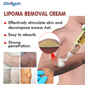 Zourunan OEM Unguento per Linfoma Ascellare, Crema per Lipomi e Discomodi Nodulari - Product Image 2