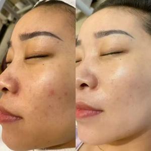 Sérum Éclaircissant et Hydratant pour le Visage Luminous Beauty Salon – Lot d'Essences Tonifiantes pour une Peau Lumineuse - Product Image 5