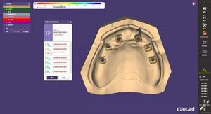 Software Dental EXOCAD 3.3 Chemnitz para Laboratorio Dental, CAD Dental, Uso Vitalicio, Sin Cuota Anual, Uso Gratuito, EXOCAD 3.2 3.1 3.0 - Product Image 2
