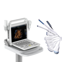 Système d'échographie médicale vétérinaire en gros, échographe cardiaque, scanner d'échographie vétérinaire