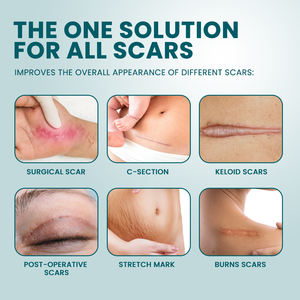 Tiras Adhesivas Reutilizables de Grado Médico para Eliminar Cicatrices, Ecológicas y a Base de Hierbas, para Cirugía de Cesárea y Cuidado de la Salud - Product Image 3