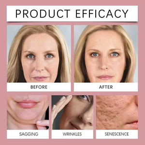 Masque facial en feuille YASIJIE à la niacinamide, glutathion et vitamine, éclaircissant et antioxydant, boîte de 4 pièces, atténue les taches brunes, anti-terne, hydratant, pour tous types de peau - Product Image 4