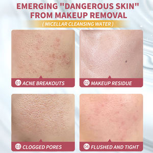 <span class=keywords><strong>Agua</strong></span> <span class=keywords><strong>Micelar</strong></span> Natural UUKKG, <span class=keywords><strong>Agua</strong></span> Desmaquillante para la Eliminación del Maquillaje y Tonificación de la Piel, Cuidado Suave, <span class=keywords><strong>Agua</strong></span> <span class=keywords><strong>Micelar</strong></span> Desmaquillante - Product Image 5