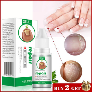 SUAI Venta al por mayor Cuidado de las uñas Engrosamiento de uñas brillante Tratamiento fúngico Reparación de uñas grises Líquido antibacteriano - Product Image 4
