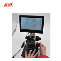High-Resolution Nailfold Microcirculation Microscope for Medical Diagnostics