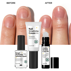 Solución Nutritiva para <span class=keywords><strong>Uñas</strong></span>, Hidrata, Repara, Nutre, Tratamiento Antihongos, Aceite para el Crecimiento de las <span class=keywords><strong>Uñas</strong></span>, Set de Productos para el Cuidado de <span class=keywords><strong>Manos</strong></span> y Pies - Product Image 1