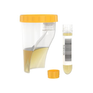 Gobelet à urine sans aiguille avec tube détachable, récipient à échantillons non stérile, conçu pour un transfert scellé, efficacité du flux de travail en laboratoire - Product Image 1
