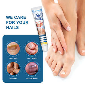 Özel Marka Etkili Bitkisel Anti-Fungal Tırnak Onarım Kremi Ayak Tırnağı Bakım Merhemi 20g - Product Image 4