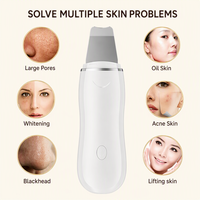 Esfoliador Facial Ultrassônico Portátil, Espátula para Limpeza de Pele, Removedor de Cravos, Limpador de Poros, Esfoliador Facial Sônico