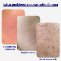 Lotion lyophilisée au peptide de cuivre bleu et au squalane, marque privée, réparation, apaisement, hydratation, peau sèche et abîmée