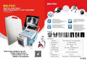 الأكثر مبيعًا من MEDSINGLONG ، جهاز الأشعة السينية المحمول بشاشة تعمل باللمس بوصة ، للاختبار الروتيني للإنسان والطبيب البيطري في المستشفيات - Product Image 5
