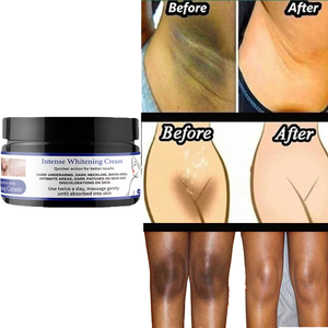 Crème blanchissante intense de marque privée OEM Gomme pour taches brunes à blanchiment rapide de la zone du bikini Ingrédient principal Glycérine - Product Image 5