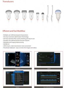 Alta resolución 3D 4D Color Doppler Ultrasonido Echo Máquina Nueva máquina de ultrasonido eléctrica de metal y plástico - Product Image 5
