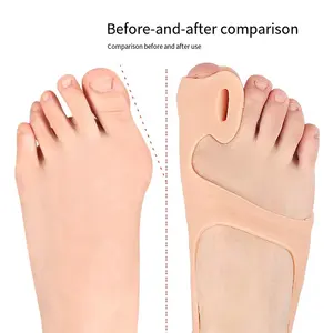 Correcteur d'<span class=keywords><strong>hallux</strong></span> <span class=keywords><strong>valgus</strong></span> en gel de silicone, séparateur à double trou, sangle de talon antidérapante, soutien de la voûte plantaire élastique, soin soulageant la douleur - Product Image 5