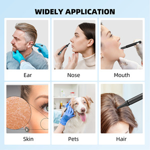 Bebird Smart Ear Cleaner Viusal strumento Di rimozione della cera per le orecchie Selezione Auricolare <span class=keywords><strong>Visiva</strong></span> ottica Di pere Auricolari Con fotocamera - Product Image 5