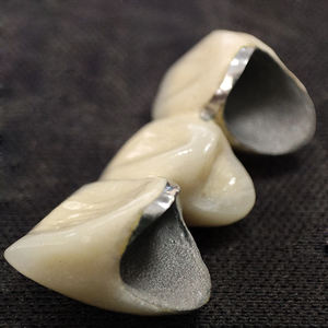 Metallo ceramico dentiere produttore di prodotti dentali Custom Pfm corone ponti con rosa gomma porcellana - Product Image 6