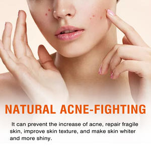 เจลบำรุงผิวกรดซาลิไซลิกให้ความชุ่มชื้นคืนความอ่อนเยาว์ให้ผิวลดรอยแผลเป็นนวดป้องกันสิว - Product Image 4