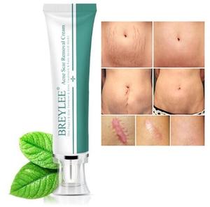 Crème Réparatrice Marque Blanche pour Peau, Estompe les Cicatrices et Vergetures, Crème Cicatrisante Post-Opératoire, Élimination de l'Acné, Soin de la Peau, Produits de Beauté pour Femmes - Product Image 1