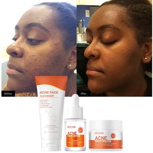 Juego de cuidado de la piel para eliminación de acné que incluye limpiador de crema facial para acné y suero Facial Refine los poros <span class=keywords><strong>Kit</strong></span> DE CUIDADO DE LA PIEL hidratante MOOYAM - Product Image 1