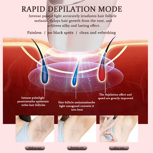 Appareil d'épilation IPL Épilateur IPL avec refroidissement par glace Épilation au <span class=keywords><strong>laser</strong></span> permanente Machine d'épilation IPL 510K pour femmes et hommes - Product Image 4