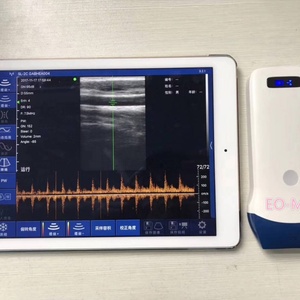 Échographe Doppler Couleur Portable Sans Fil 128 Éléments Sonde Linéaire 7.5 & 10 MHz à Bon Prix Modèle CU12 - Product Image 2