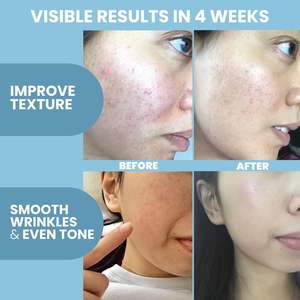 Sérum anti-âge au peptide de cuivre GHK-Cu pour le soin de la peau, marque privée, soin du visage liquide anti-âge, Snap8 <span class=keywords><strong>Plus</strong></span> Ghkcu Serum - Product Image 5