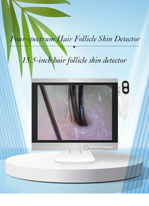 Professional HD Hair Follicles Scalp Scanner Detector Hair Analyzer Handheld Skin Analyzer for Beauty Salons or Home Use - Product Image 2