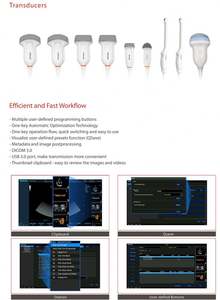أدوات الموجات فوق الصوتية الطبية Medsinglong Color-Ecocardiografo محمولة 4d 5d - Product Image 4