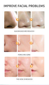 Haute Qualité Marque Privée Soins Du Visage Sommeil Masque Facial Hydratant <span class=keywords><strong>Melon</strong></span> Bulles Visage Masque À L'argile - Product Image 5