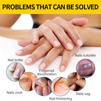 Sérum Traitement Anti-Champignons des Ongles Puissant et Efficace en 7 Jours, Solution Réparatrice et Nourrissante pour Ongles Abîmés Naturels