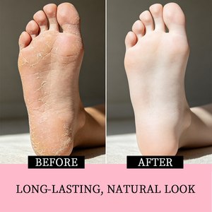 Crème pour les pieds au magnésium, marque privée, anti-crevasses, anti-dessèchement, nourrissante, hydratante, adoucissante pour les callosités, exfoliante - Product Image 2