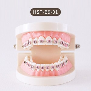 Modelo de Ortodoncia Dental Serie HST B6 con Aparatos para Práctica y Enseñanza - Product Image 2