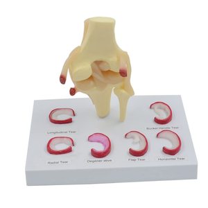 Modèle anatomique de l'articulation du genou avec ménisque pour l'enseignement médical, les études <span class=keywords><strong>cliniques</strong></span> et la communication médecin-patient avec CE - Product Image 2