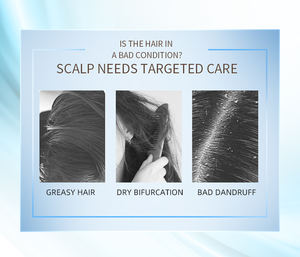 Ensemble de soins capillaires pour hôtel prêt à être expédié, traitement à la kératine, produits de beauté, shampooing et après-shampooing sans sulfate à prix avantageux - Product Image 4