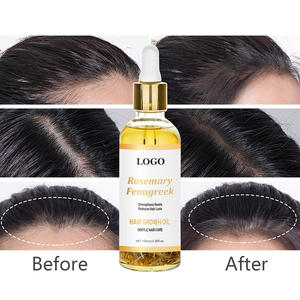 น้ำมันบำรุงผมสูตรโรสแมรี่และเฟนูกรีกสำหรับแบรนด์ส่วนตัว |   เสริมสร้างรากผม ลดการหลุดร่วงของเส้น<span class=keywords><strong>ผม</strong></span> และส่งเสริมให้<span class=keywords><strong>ผม</strong></span>หนาขึ้น สุขภาพดีขึ้น - Product Image 1