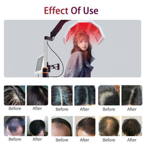 Analizador portátil del cuero cabelludo BIO Ozono Estimulación del crecimiento del cabello Instrumento de cuidado 650nm Máquina de rebrote de terapia de oxígeno - Product Image 5