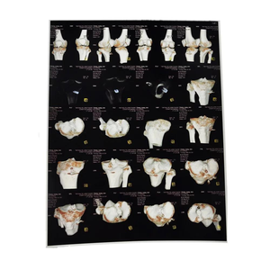 Deshiwe White B Echografie Medische Inkjetfilm 210 <span class=keywords><strong>Um</strong></span> Huisdier Waterdicht Voor Epson Voor Printers - Product Image 1