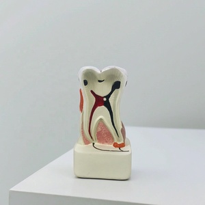 Modelo <span class=keywords><strong>de</strong></span> Patología Dental para Educación Dental y Laboratorio Dental, Modelo <span class=keywords><strong>de</strong></span> Estudio Dental - Product Image 4