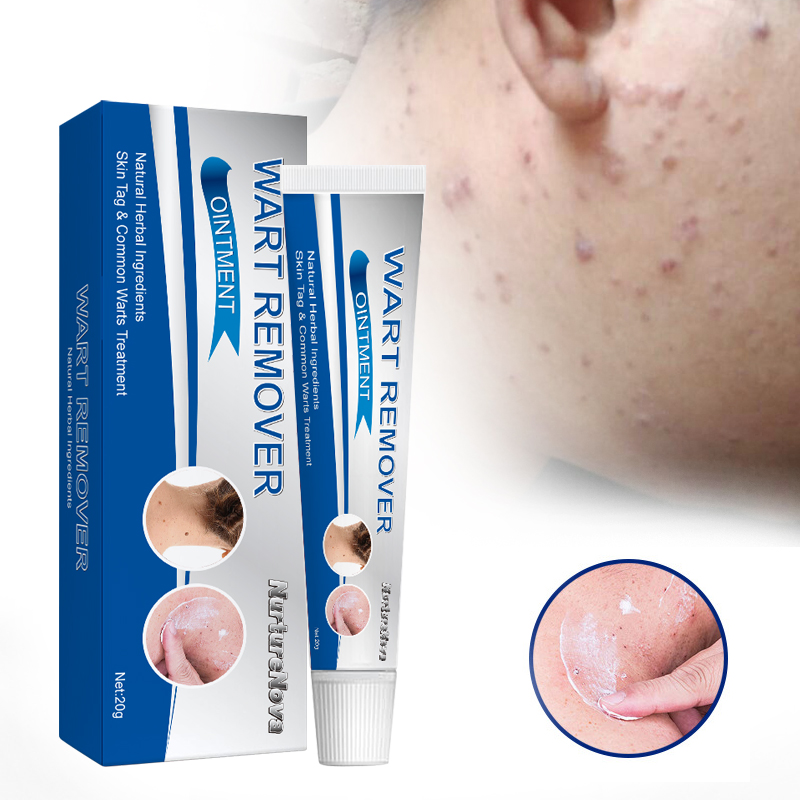 Wholesale and OEM Wart Remover Ointment Skin Care Ointment for Removing Verruca Plana and Corns