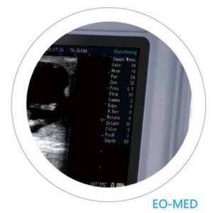 Appareil d'échographie vétérinaire, scanner à ultrasons portable V10 - Product Image 3