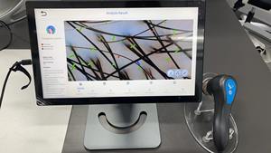 Analizador de Cuero Cabelludo con IA Profesional, Dispositivo de Análisis Capilar de Alta Gama, Equipo de Peluquería y Cuidado del Cabello - Product Image 2