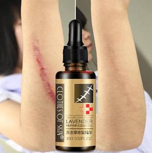 Benutzer definiertes Logo Schwangere Frauen Hyaluron säure Serum öl Ätherisches Gesicht Ätherische Massage Narben entfernung Lavendelöl - Product Image 3