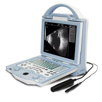 Scanner à ultrasons ophtalmique portable pour les cliniques de santé oculaire Capacités A-Scan et B-Scan pour des diagnostics oculaires complets.