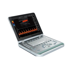 Escáner de ultrasonido Doppler a color para computadora portátil Precios de plástico eléctrico Ce de máquina de ultrasonido - Product Image 1
