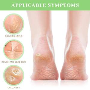 Maschera Esfoliante per Piedi all'Aloe Vera OEM all'Ingrosso, Calzini Spa per Piedi Secchi e Screpolati, Idratante, Rimuove la <span class=keywords><strong>Pelle</strong></span> Morta dai <span class=keywords><strong>Talloni</strong></span> - Product Image 3